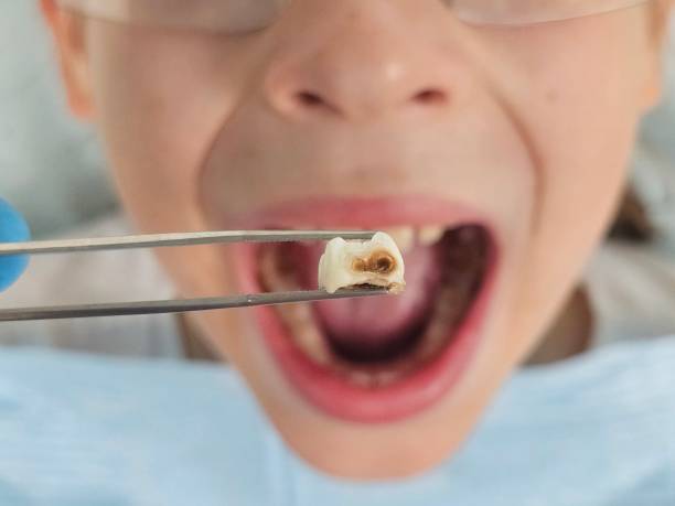 Best Emergency Dentist for Special Needs Patients in Advae, NC