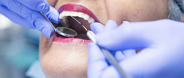 Best Emergency Dental Care for Abscessed Tooth in Advae, NC